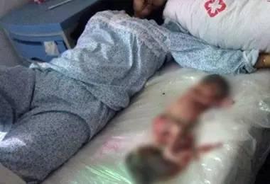 吃瓜引产婴儿,揭开医疗伦理与人伦道德的冲突